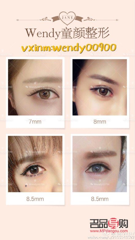 双眼皮7mm恢复后多宽图片女(双眼皮7mm恢复后多宽图片女生) 双眼皮7mm恢复后多宽图片女(双眼皮7mm恢复后多宽图片女生)