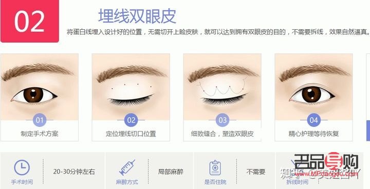 无痕迹双眼皮与埋线双眼皮的区别详解