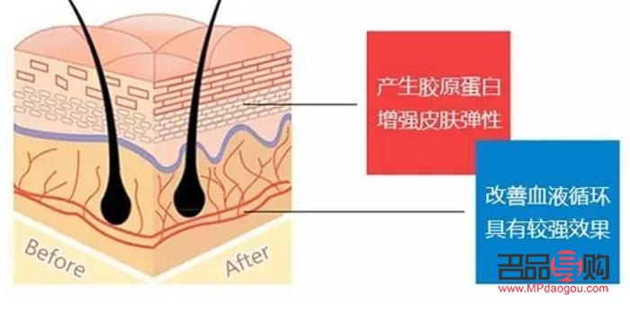 <h3>美容面部线雕：塑造青春轮廓的秘籍</h3>