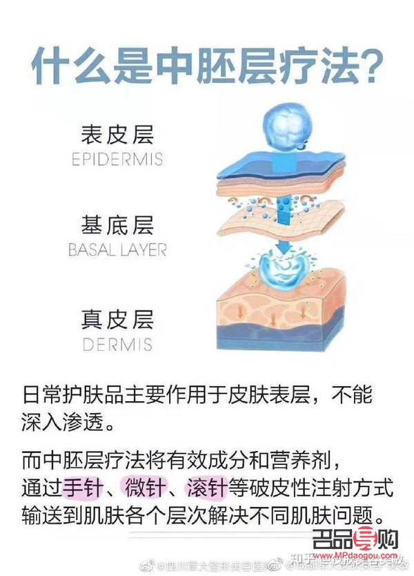 什么是中胚美容(什么是中胚美容有副作用吗)