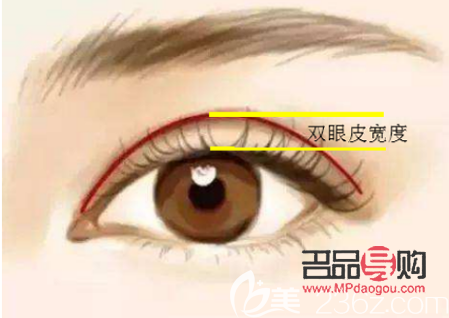 怎么可以让内双变成外双双眼皮(怎么可以让内双变成外双双眼皮图片) 怎么可以让内双变成外双双眼皮(怎么可以让内双变成外双双眼皮图片)