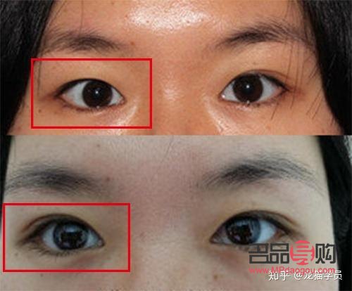 一单一双的眼皮怎么办(一单一双的眼皮怎么办才好看)