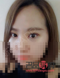 一单一双的眼皮怎么办(一单一双的眼皮怎么办才好看)