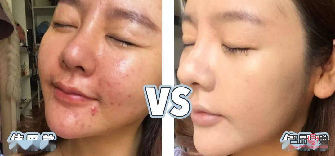 探讨未洗脸状态下的美容可能性