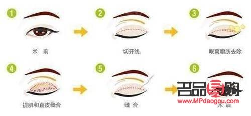 眼综合一共有多少个项目(眼综合一共有多少个项目可以做)