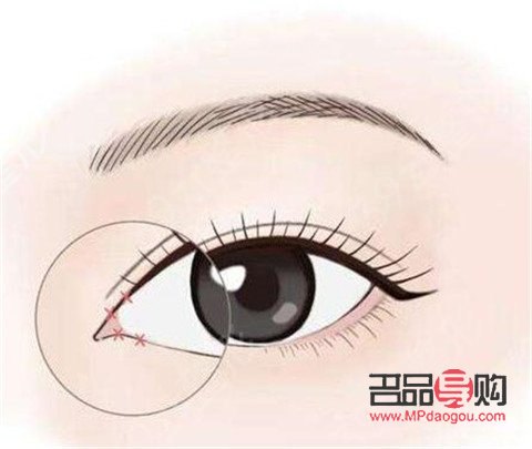 眼综合一共有多少个项目(眼综合一共有多少个项目可以做)