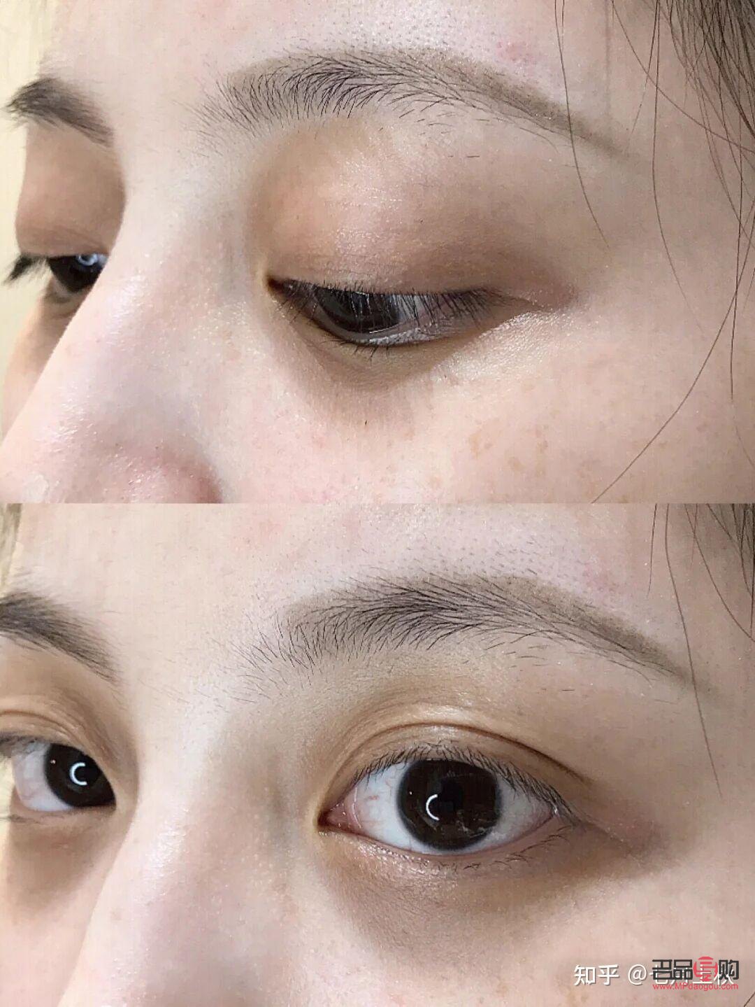 学生怎么去眼袋和黑眼圈(学生怎么去黑眼圈和眼袋的简单方法) 学生怎么去眼袋和黑眼圈(学生怎么去黑眼圈和眼袋的简单方法)