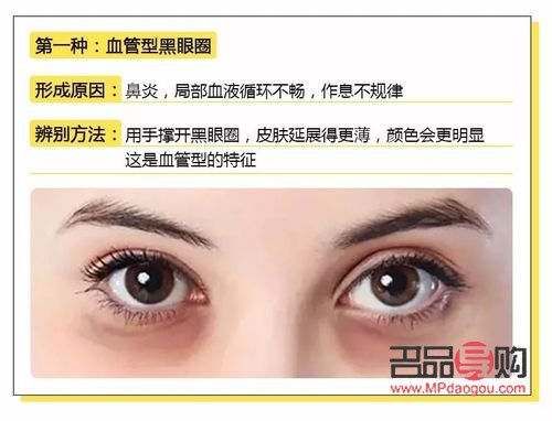 学生怎么去眼袋和黑眼圈(学生怎么去黑眼圈和眼袋的简单方法) 学生怎么去眼袋和黑眼圈(学生怎么去黑眼圈和眼袋的简单方法)