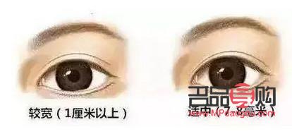 开扇形双眼皮真人图片(开扇形双眼皮的图片)