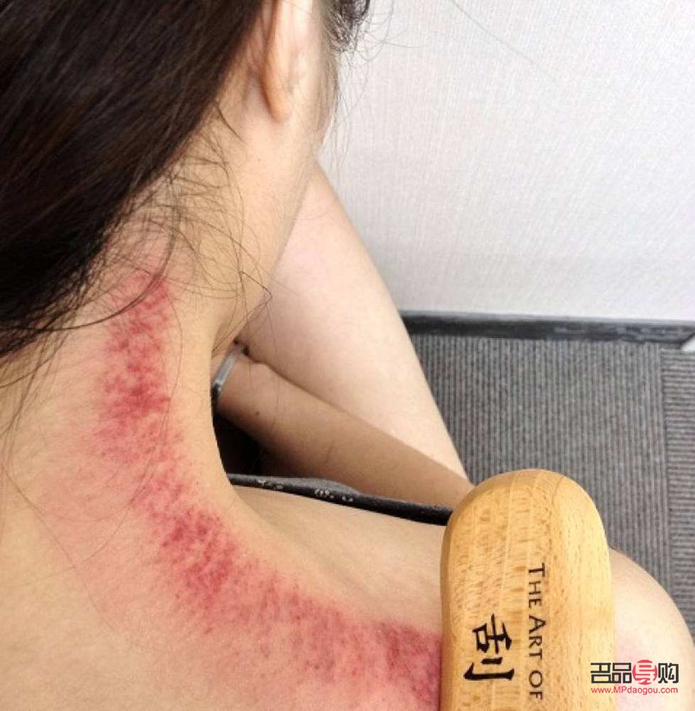 美容院刮痧多少钱(美容院刮痧多少钱一次)
