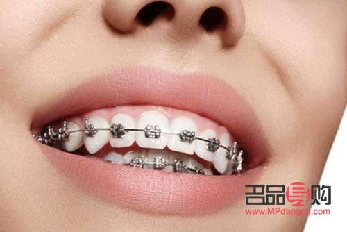 <h3>美容院整牙齿吗？专业解答与注意事项</h3>