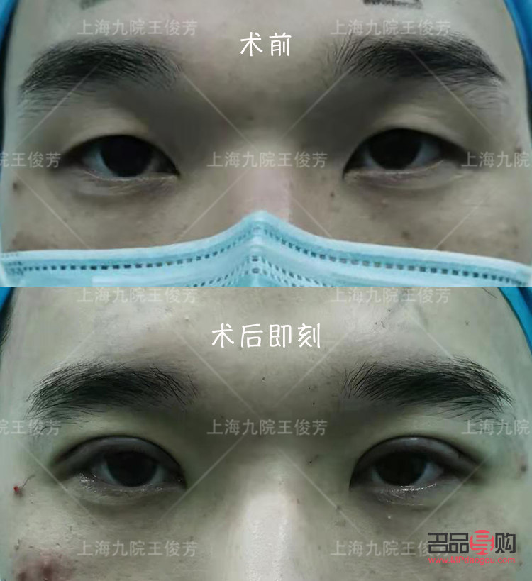 <h3>现在流行做什么样的双眼皮</h3> <h3>现在流行做什么样的双眼皮</h3>