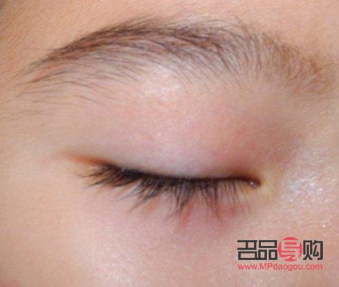 <h3>如何揉出双眼皮疤痕：专业指导与注意事项</h3>