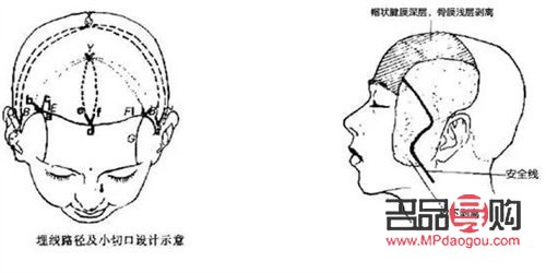 头悬可以美容吗(头部悬厘)