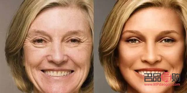 眼睛下面皱纹怎么去除最有效果