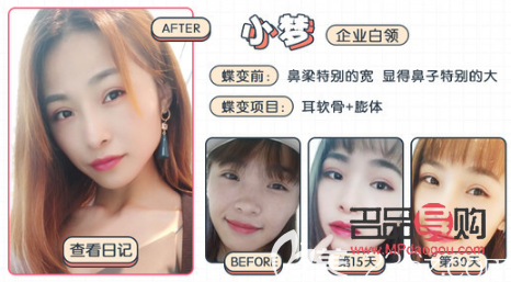 非凡美容怎么样(非凡美容怎么样可靠吗)