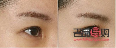 <h3>如何让内双眼皮变外双眼皮呢</h3>