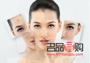 美容有什么方法(美容有什么方法可以祛斑)