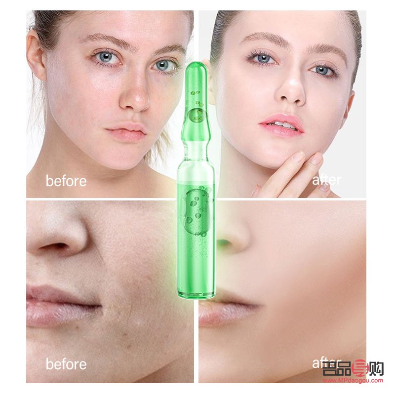 <h3>干皮怎么护理身体好</h3>