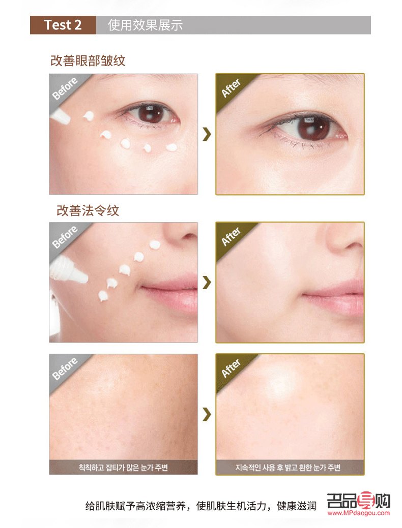 <h3>怎样淡化泪沟和眼袋</h3> <h3>怎样淡化泪沟和眼袋</h3>