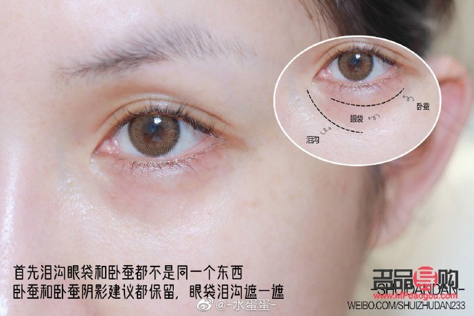 怎样淡化泪沟和眼袋