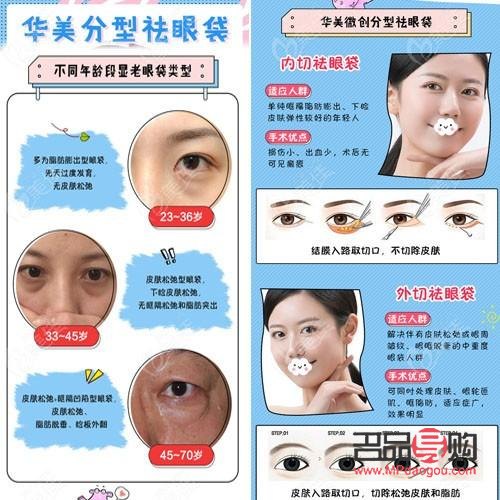 眼袋修复专家排名(眼袋修复专家排名)