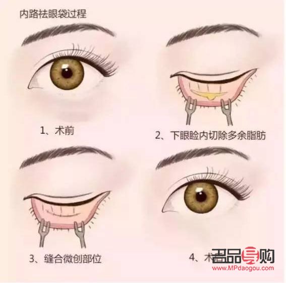 眼综合是做什么项目(眼综合是做哪些项目)