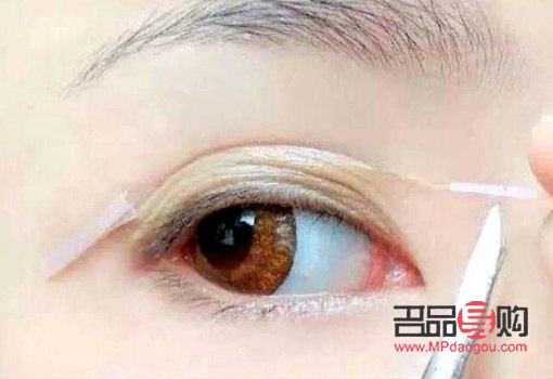 上眼皮松适合做什么样的双眼皮(上眼皮松适合做什么样的双眼皮手术)