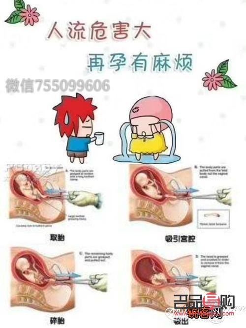 打胎后如何科学护理身体