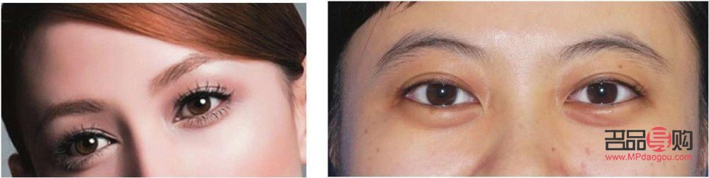 <h3>眼轮匝肌折叠卧蚕再造——上海九院打造迷人电眼新选择</h3> <h3>眼轮匝肌折叠卧蚕再造——上海九院打造迷人电眼新选择</h3>