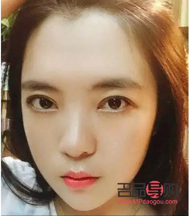 纳米双眼皮和埋线双眼皮的区别(纳米双眼皮和埋线双眼皮的区别是什么)