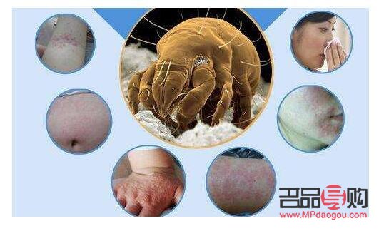 做美容去螨虫吗(做美容去螨虫吗有效果吗) 做美容去螨虫吗(做美容去螨虫吗有效果吗)