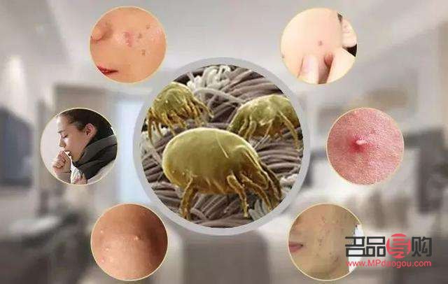 做美容去螨虫吗(做美容去螨虫吗有效果吗) 做美容去螨虫吗(做美容去螨虫吗有效果吗)