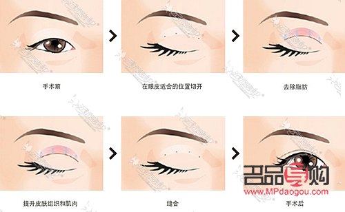 <h3>眼综合全部项目详解:打造迷人电眼</h3> <h3>眼综合全部项目详解:打造迷人电眼</h3>