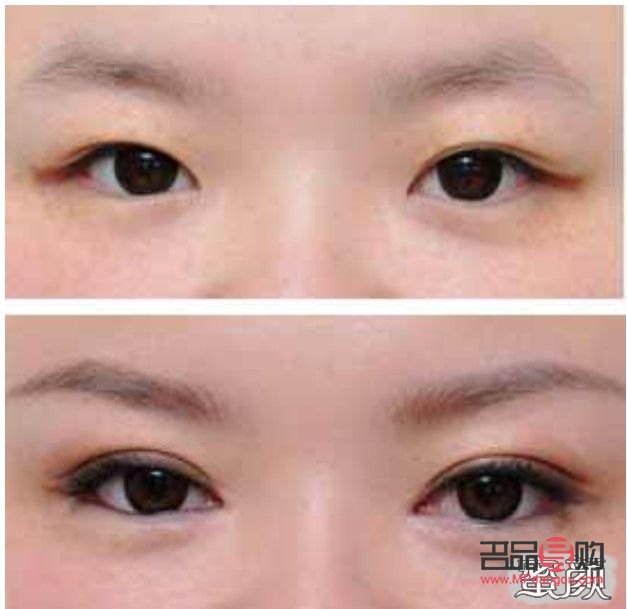 <h3>眼综合全部项目详解:打造迷人电眼</h3> <h3>眼综合全部项目详解:打造迷人电眼</h3>