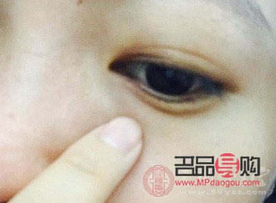 眼皮下垂怎么自然恢复吃什么好(眼皮下垂怎么做会改善)