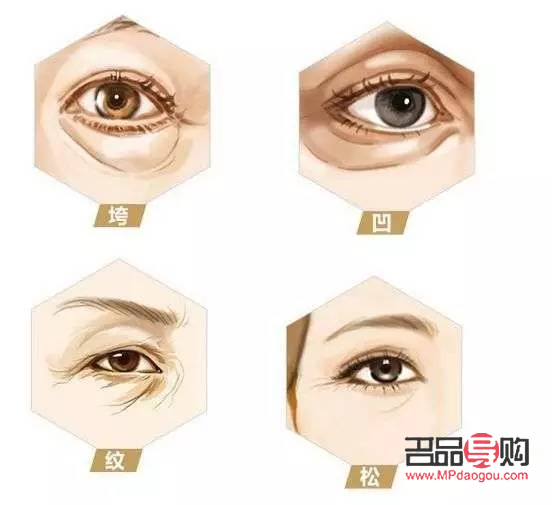 眼皮松弛了还能恢复吗图片(眼皮松弛了还能恢复吗图片大全) 眼皮松弛了还能恢复吗图片(眼皮松弛了还能恢复吗图片大全)