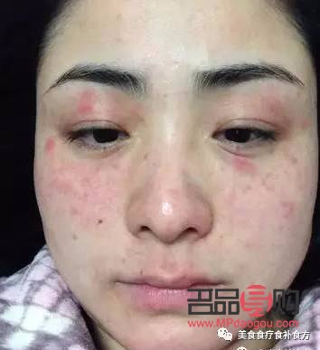 怎么测彩妆过敏(怎么测彩妆过敏不过敏)