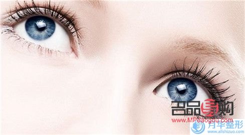 翘睫术双眼皮能保持多久恢复