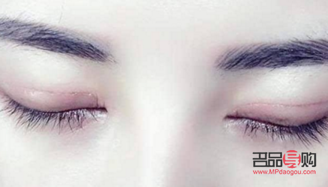 全切双眼皮手术过程视频(全切双眼皮手术过程视频真人图片)