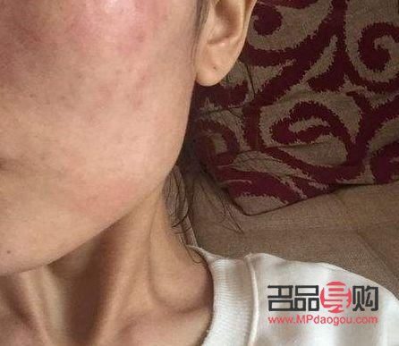 怎么测彩妆过敏了(怎么测彩妆过敏了呢)