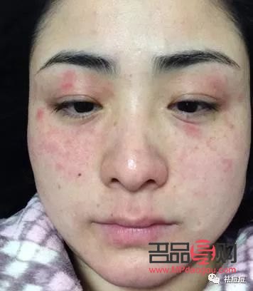 怎么测彩妆过敏了(怎么测彩妆过敏了呢)