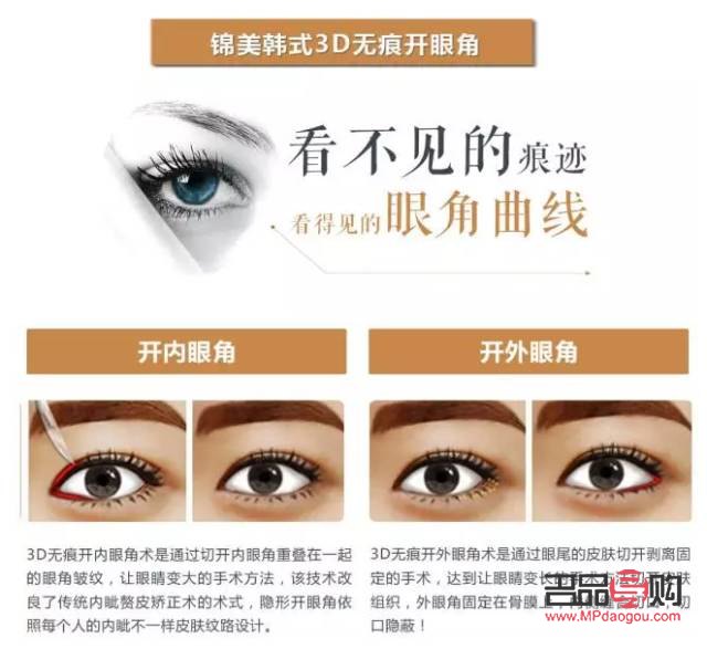 <h3>双眼皮哪几种眼型好看</h3>