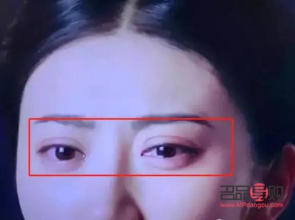 双眼皮都有哪几种类型图片(双眼皮都有哪几种类型图片) 双眼皮都有哪几种类型图片(双眼皮都有哪几种类型图片)