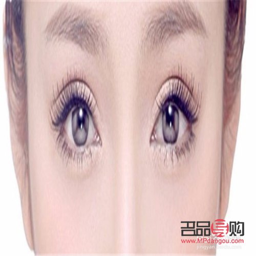 双眼皮都有哪几种类型图片(双眼皮都有哪几种类型图片) 双眼皮都有哪几种类型图片(双眼皮都有哪几种类型图片)