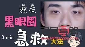 黑眼圈如何快速消除学生(黑眼圈怎么样快速消除学生) 黑眼圈如何快速消除学生(黑眼圈怎么样快速消除学生)