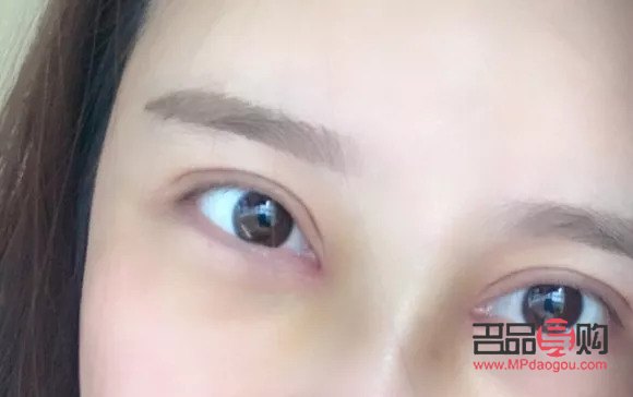 小眼睛开眼角双眼皮效果图大全(小眼睛开眼角双眼皮效果图大全图片) 小眼睛开眼角双眼皮效果图大全(小眼睛开眼角双眼皮效果图大全图片)