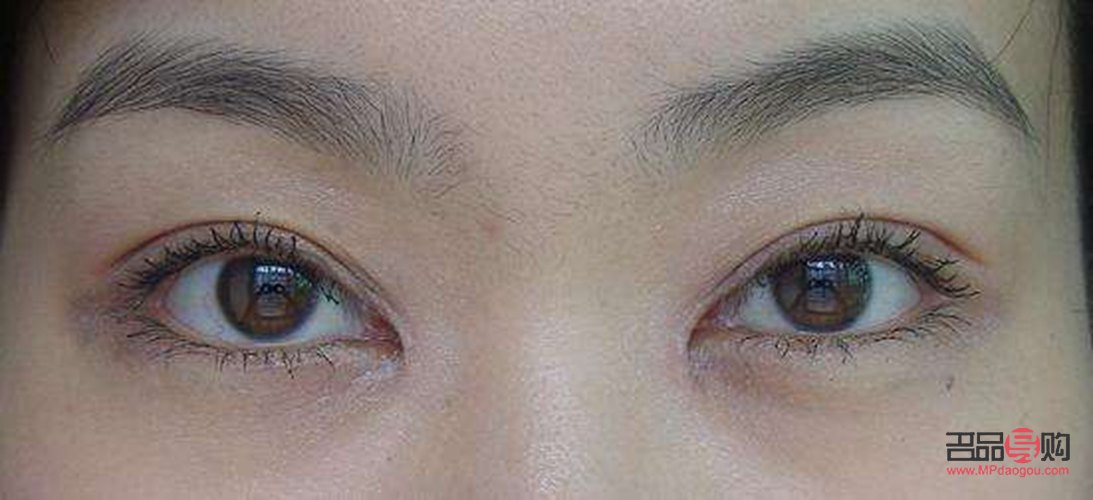 小眼睛开眼角双眼皮效果图大全(小眼睛开眼角双眼皮效果图大全图片)
