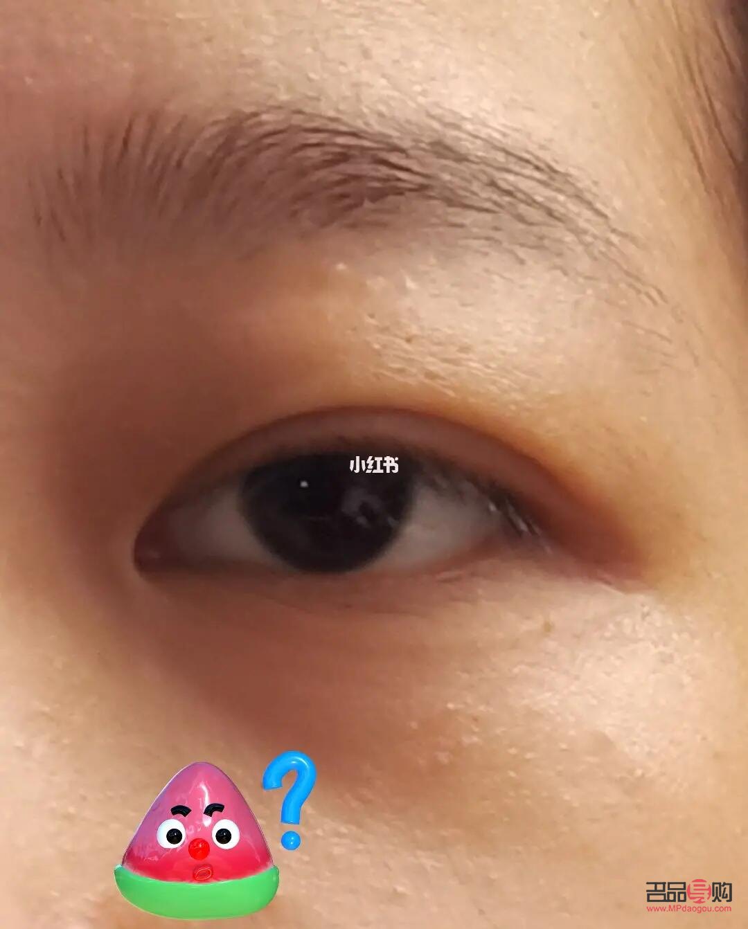 儿童肿眼泡怎么消除最快方法(儿童肿眼泡怎么消除最快方法图解) 儿童肿眼泡怎么消除最快方法(儿童肿眼泡怎么消除最快方法图解)