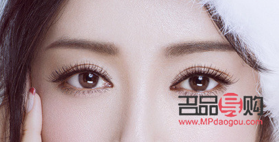 5g桃花眼双眼皮恢复期多久(5g桃花眼双眼皮能管多久)